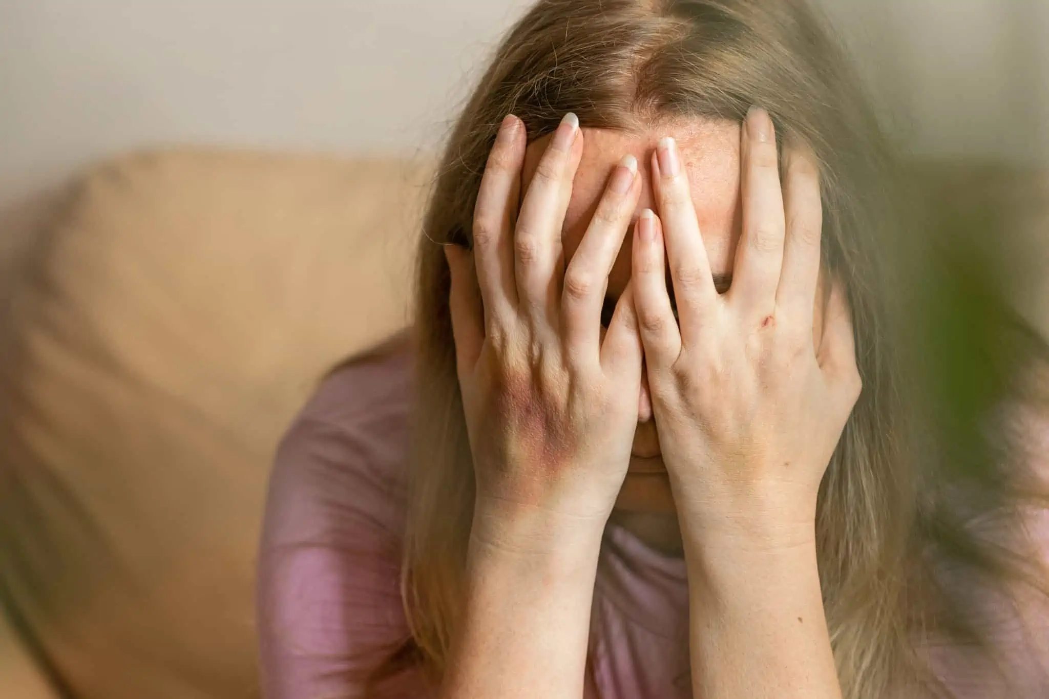 mulher, vítima de violência doméstica, em sofrimento, tapa o rosto com as mãos