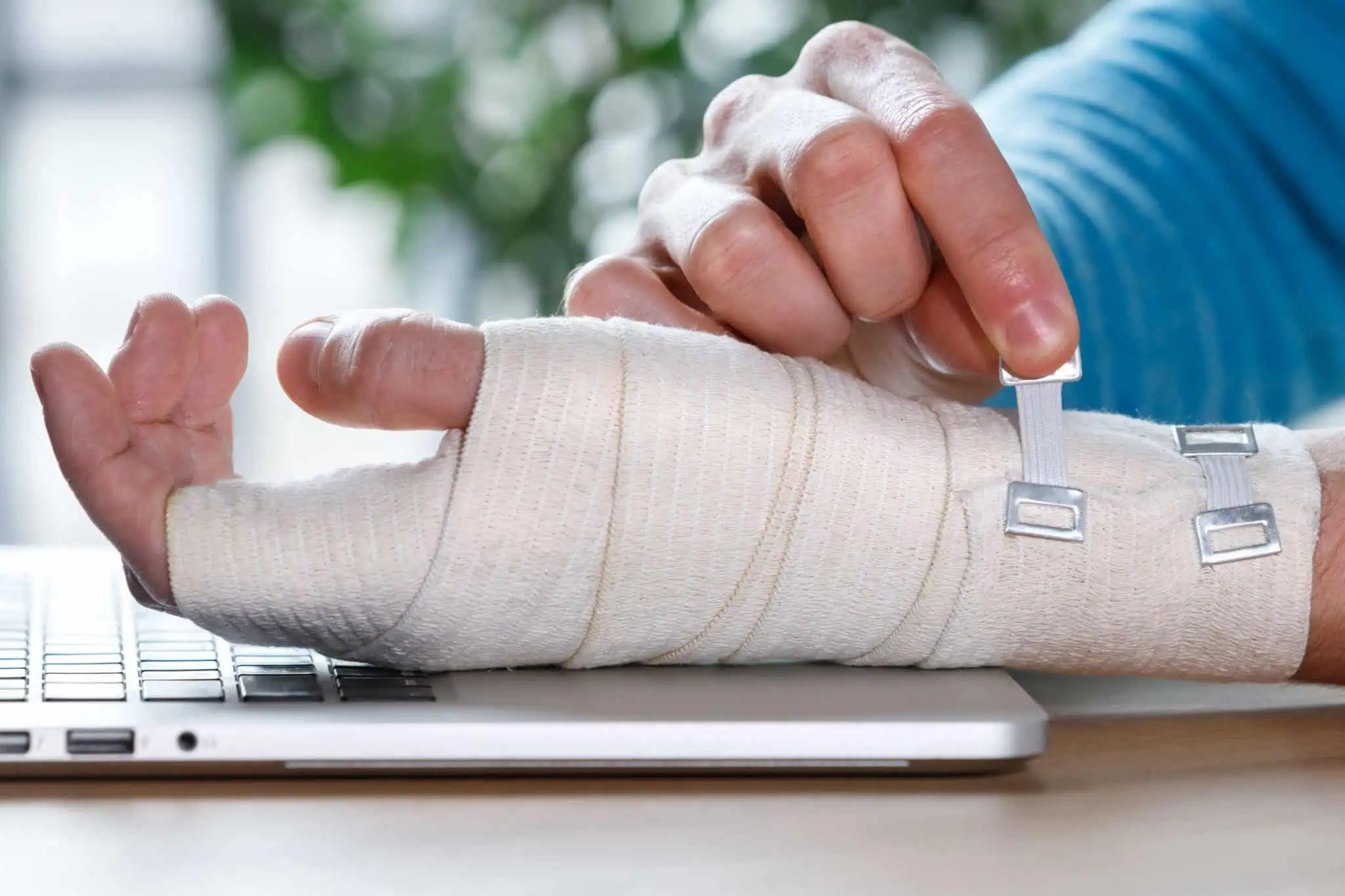 Devo ter um seguro de acidentes pessoais? mão de jovem pousada ao lado do teclado de um computador portátil que está enrolada com ligaduras, com despesas apoiadas por ter seguro de acidentes pessoais